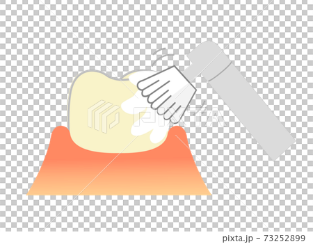 PMTC 歯のクリーニング:歯科イラスト 73252899