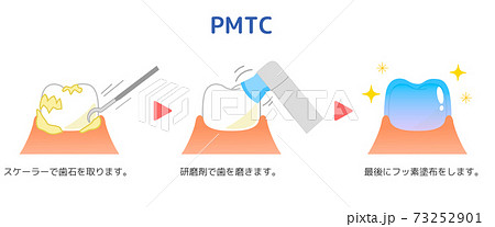 Pmtc 歯のクリーニング 歯科イラストのイラスト素材