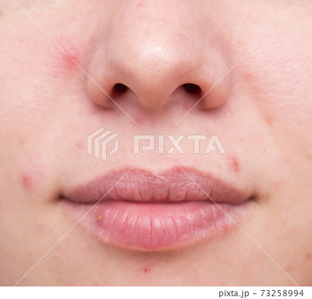 Problematic woman skin 73258994