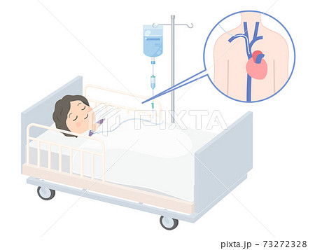 Ivh 中心静脈栄養のイラスト おばあちゃん 図解のイラスト素材