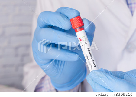 hand in medical gloves holding corona blood test tube with copy space  73309210