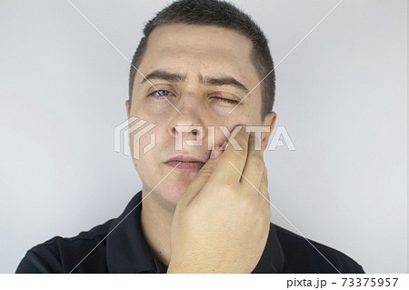 A man stands in front of a mirror and sees inflammation of the upper eyelid. Redness of the skin around the eyes and blepharitis. A man stands in front of a mirror and sees inflammation of the upper eyelid. Redness of the skin around the eyes and blepharitis. 73375957