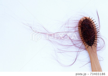 Hairs loss fall in comb on white background. 73403186