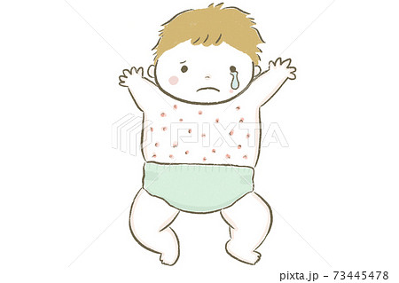 お腹にアトピーができた赤ちゃんのイラスト素材