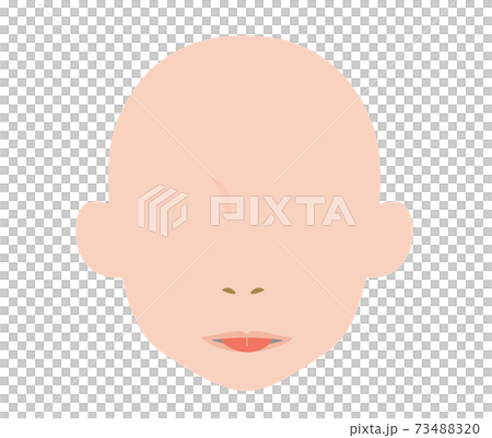 舌小帯短縮症で伸ばせない舌のイラスト 舌小帯短縮症で伸ばせない舌のイラスト 73488320