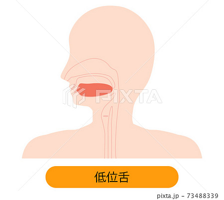 低位舌のイラスト 73488339