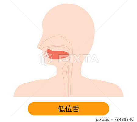 低位舌のイラスト 73488340