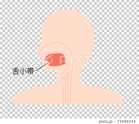 舌小帯のイラスト 舌小帯のイラスト 73488344