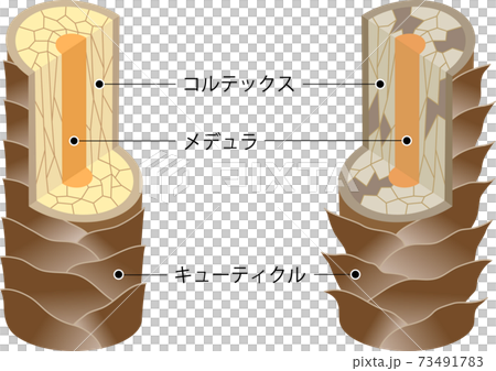 髪のしくみ　健康な髪と傷んだ髪 73491783