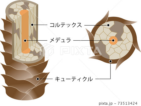 傷んだ髪 断面図 傷んだ髪 断面図 73513424