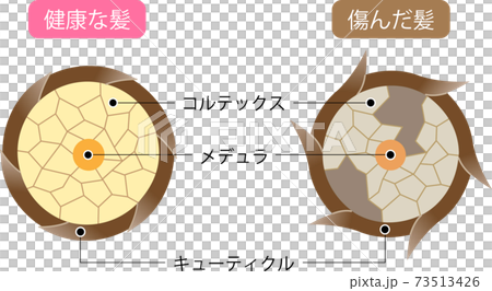 頭髮如何運作健康的頭髮和受損的頭髮 頭髮如何運作健康的頭髮和受損的頭髮 73513426