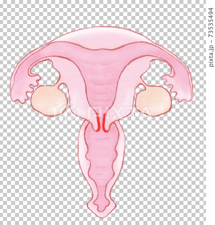 子宮膣部びらん 名称ナシのイラスト素材 [73535494] - PIXTA