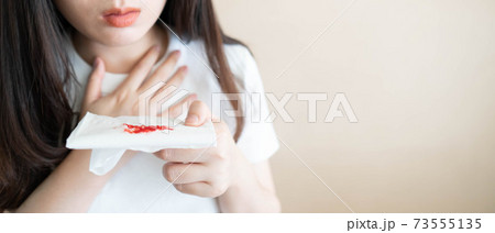 Woman have a coughing up blood and chest pain. Close up of hands holding tissue paper with bloody sputum. Cause of hemoptysis include TB, lung cancer, bronchitis, pneumonia or pulmonary embolism. 73555135