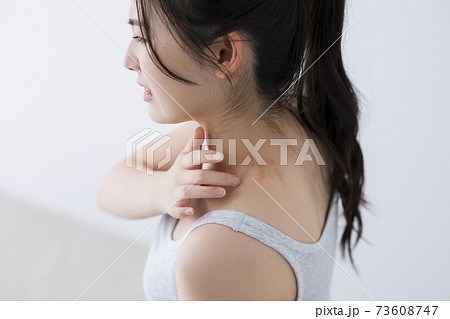 じんましんイメージ　(特殊メイク)  73608747