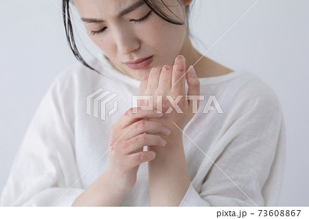 手荒れイメージ　(特殊メイク)  73608867