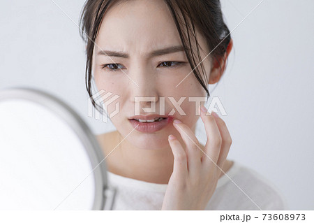 口角炎イメージ　(特殊メイク) 　　 73608973