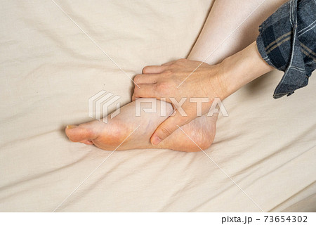 浮腫んだ女性の脚に手を当てる 73654302