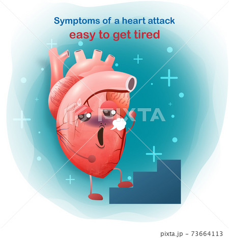 Human heart anatomy. Coronary artery, Internal organ concept. Vector modern style cartoon character. White and blue background for web and medical apps. Vector illustration. Human heart anatomy. Coronary artery, Internal organ concept. Vector modern style cartoon character. White and blue background for web and medical apps. Vector illustration. 73664113