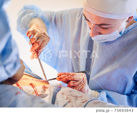 Female doctor stitching up wound after abdominoplasty procedure. 73693643