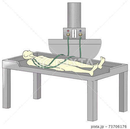 エンバーミングの「注入」工程で防腐固定液を注入する様子2　人物なし 73706176