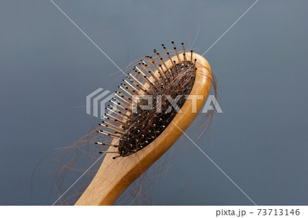 Hairs loss fall in comb on dark background. Hairs loss fall in comb on dark background. 73713146