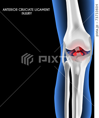 Medical orthopedic abstract background....のイラスト素材 [73733604] - PIXTA