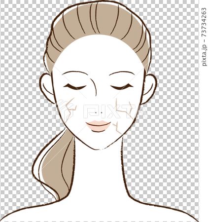 乾燥肌のイラスト 乾燥肌のイラスト 73734263