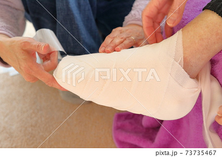 足指骨折 包帯撒きの写真素材