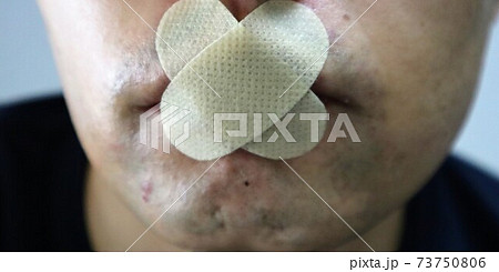 口が堅い男性のクローズアップ 73750806