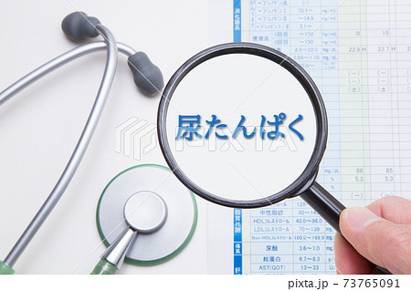 尿たんぱく 尿タンパク 医療イメージ 尿たんぱく 尿タンパク 医療イメージ 73765091