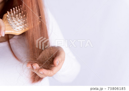 Hair fall problem, closeup hand holding comb and problem hair. Healthcare medical or daily life concept. Hair fall problem, closeup hand holding comb and problem hair. Healthcare medical or daily life concept. 73806185