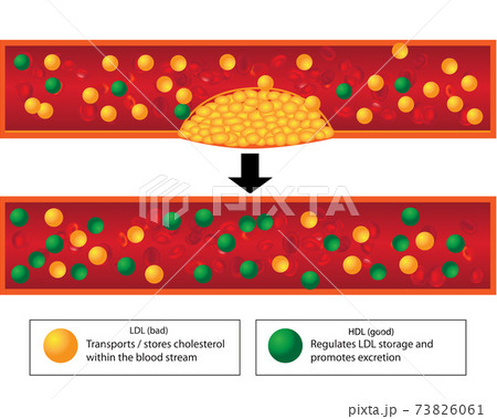 Role Of Good And Bad Lipids And Levels Of のイラスト素材