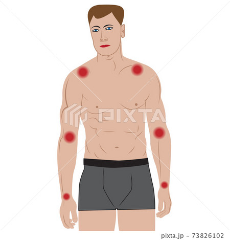 Joint pain in arms from infected or injury male body vector illustration Joint pain in arms from infected or injury male body vector illustration 73826102