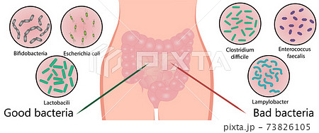 Intestinal bacterial flora. Good and bad bacterias. Vector illustration 73826105
