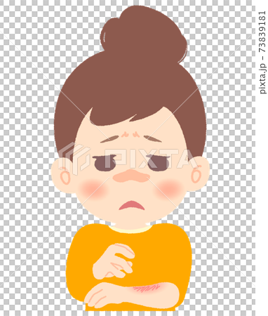 Women suffering from dry skin and skin problems 73839181