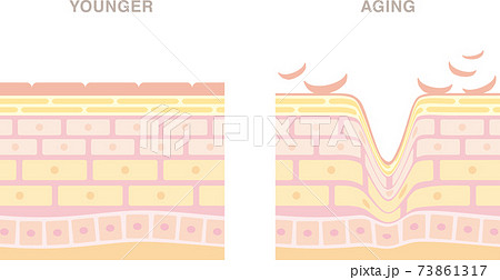 ノーマル肌とエイジング肌の断面図 明るい色合いのイラスト のイラスト素材