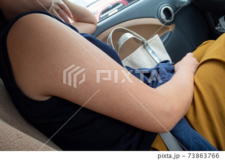 二の腕 二の腕 73863766