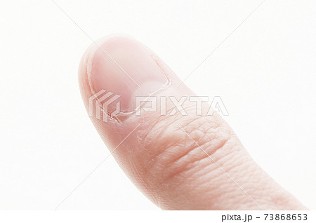 ネイルケア ネイルケア 73868653