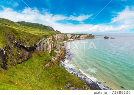 Carrick-a-Rede, Causeway Coast Carrick-a-Rede, Causeway Coast 73889136