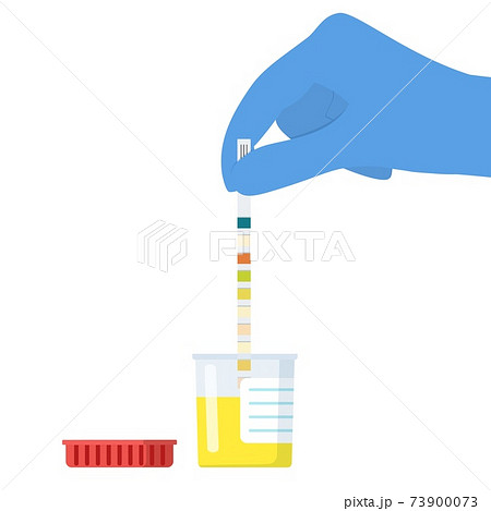 The doctor uses a urine test strip 73900073