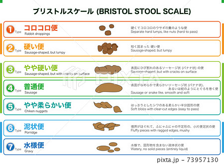 医療 ブリストル スケール Bristol Stool Scale による排便の性状分類のイラスト素材