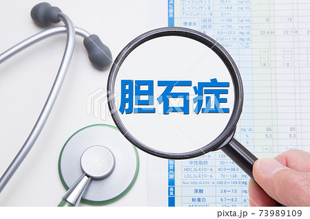 胆石症 医療イメージ 胆石症 医療イメージ 73989109