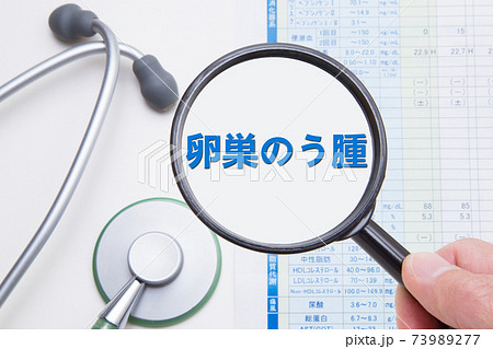 卵巣のう腫　卵巣嚢腫　医療イメージ 73989277