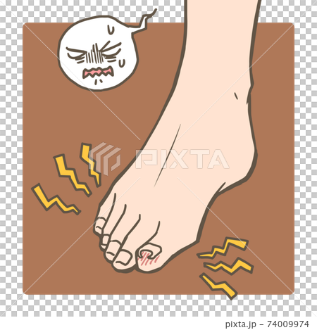 Foot trouble_ingrown nail Foot trouble_ingrown nail 74009974