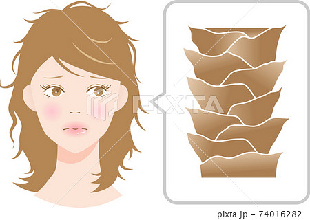 Damaged hair and cuticle woman - Stock Illustration [74016282] - PIXTA