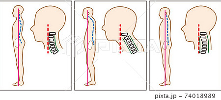 Straight neck straight-neck - Stock Illustration [74018989] - PIXTA