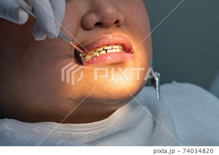 Dentist holding magifying mirror while checking teeth braces for woman 74034820