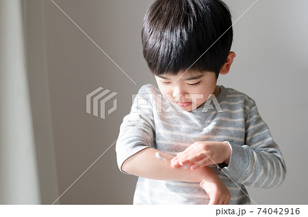 乾燥した肌に保湿クリームを塗る男の子 乾燥した肌に保湿クリームを塗る男の子 74042916