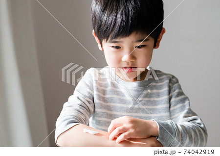 乾燥した肌に保湿クリームを塗る男の子 74042919