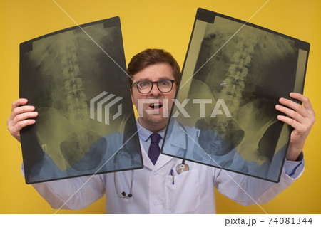 Male doctor holding x-ray or roentgen image being confused with results. Male doctor holding x-ray or roentgen image being confused with results. 74081344